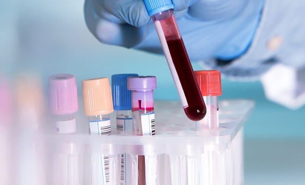 World Haemophilia Day: Over 5,000 Kenyans living with blood disorder