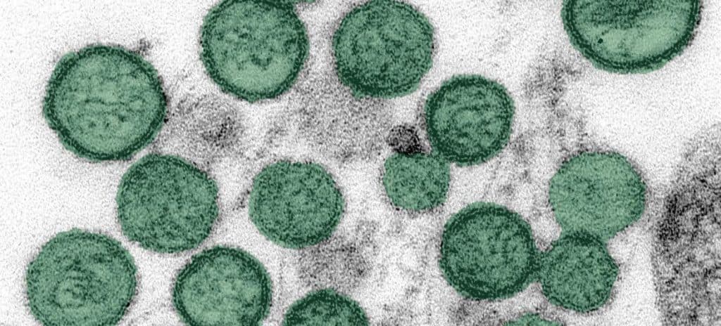 Kenya heightens port, airport surveillance over Hantavirus outbreak